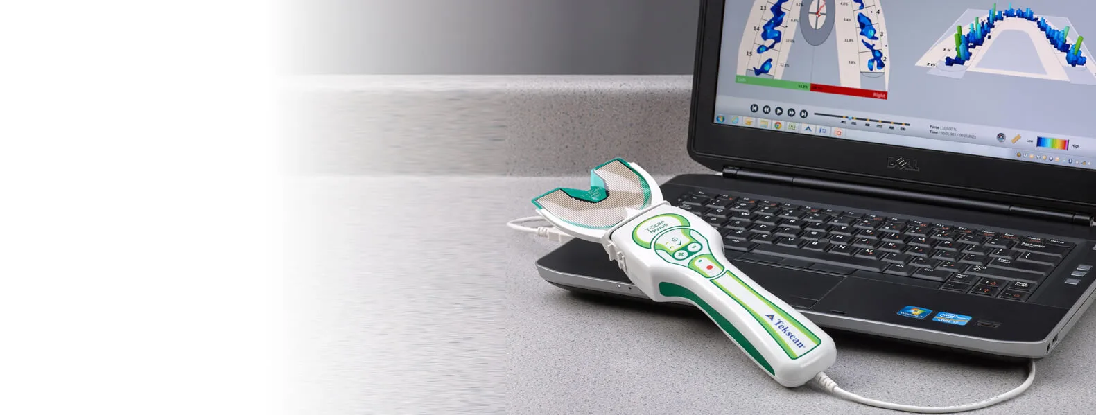 T-Scan occlusal analysis system measuring bite force in real time